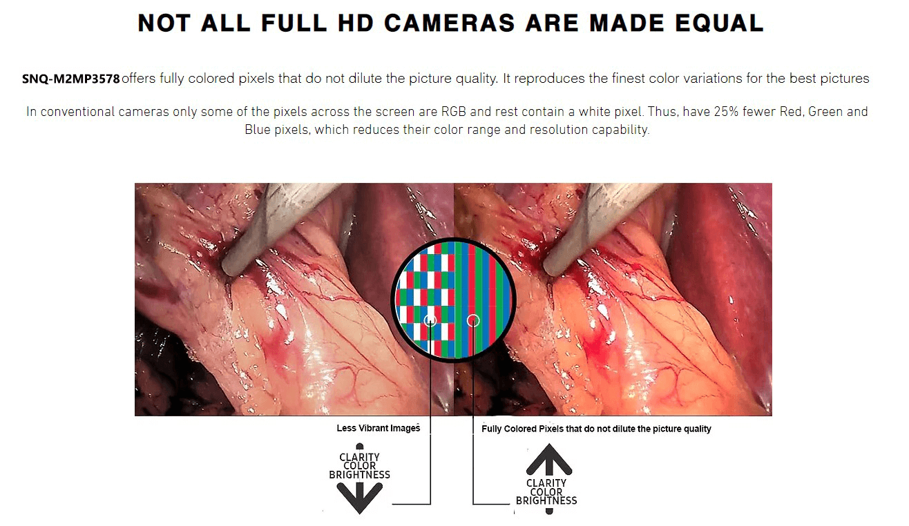 FHD Endoscopic Imaging Equipment,full HD medical endoscope,Laparoscope